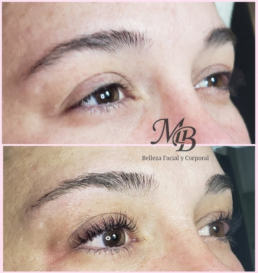 Mb Belleza facial y corporal